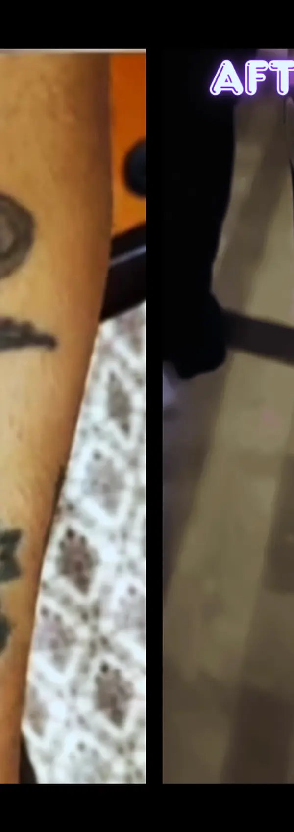 Impossible realism tiger cover up tattoo on a client's arm by a skilled artist at Inkspace Studio.